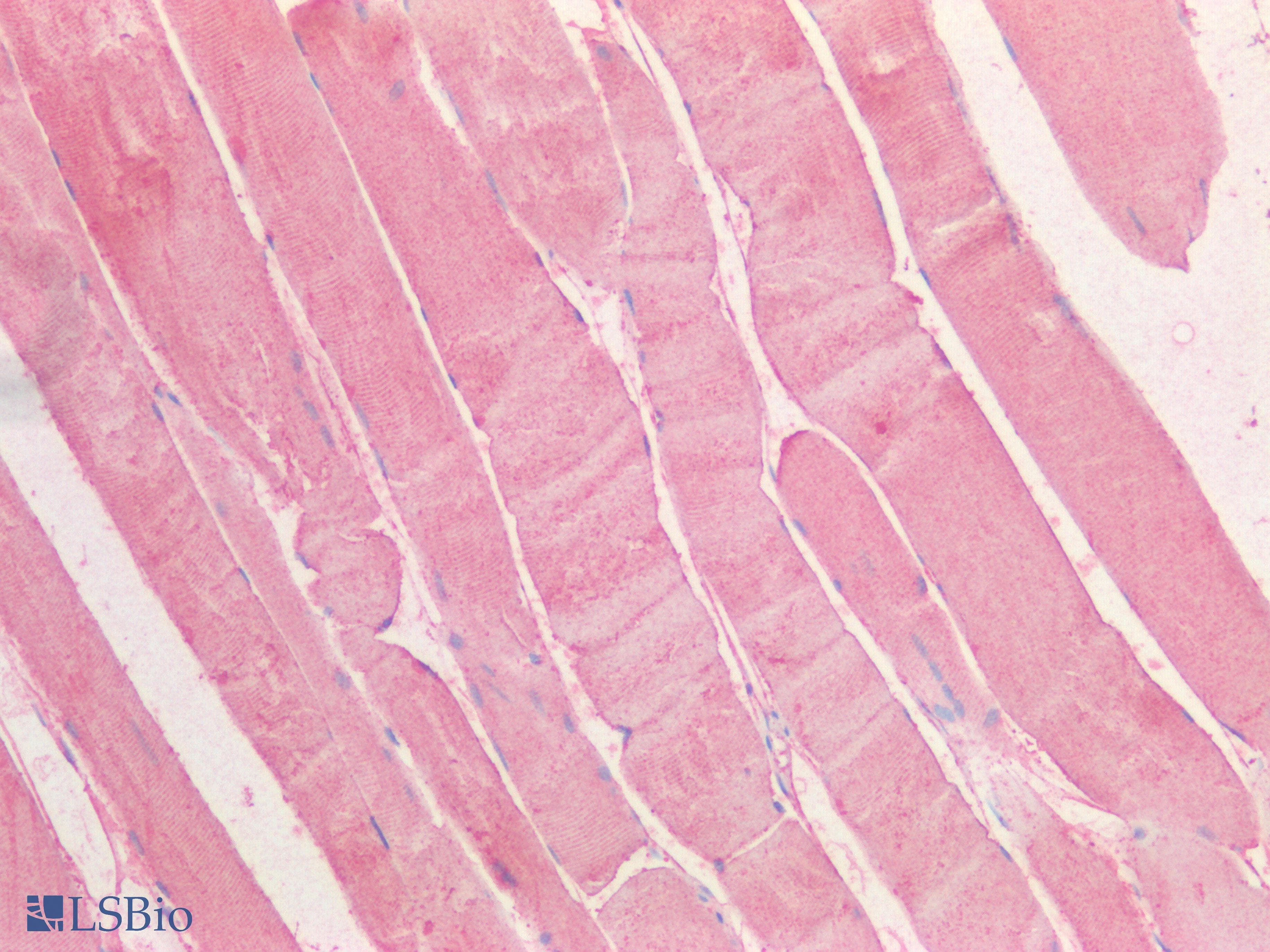 Polyclonal Rabbit anti-Human LIMS1 / PINCH Antibody (aa68-303, IHC, WB)