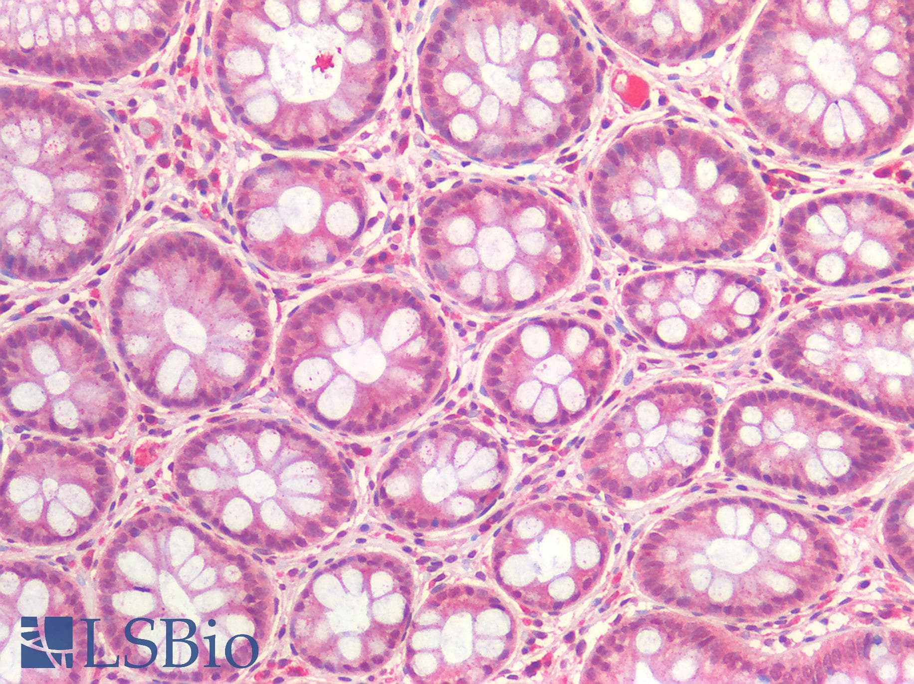 IHC-plus™ IGF1R / IGF1 Receptor Antibody