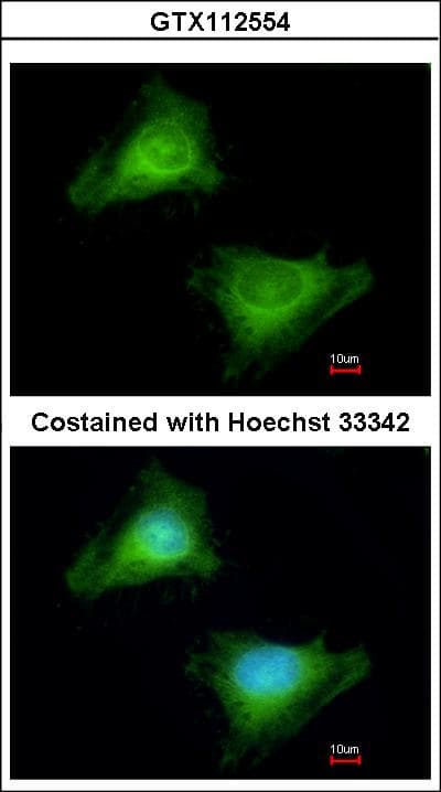 GBP3 Antibody (aa61-317)