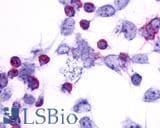 IHC-plus™ Polyclonal Rabbit anti-Human PTGER4 / EP4 Antibody (N-Terminus, IHC)
