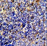 MER / MERTK Antibody