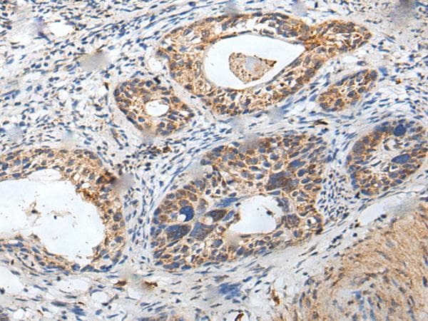 ZPBP / SP38 Antibody