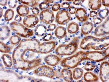 Polyclonal Rabbit anti-Human HSPA9 / Mortalin / GRP75 Antibody (IHC, WB)