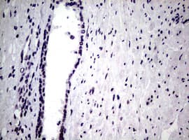 NBN / Nibrin Antibody (clone OTI6E11)