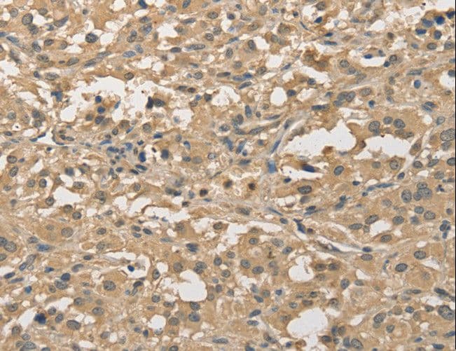 ALDH8A1 Antibody