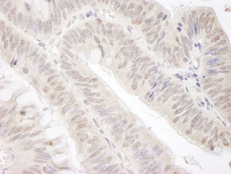 GEMIN4 Antibody (aa1010-C-term)