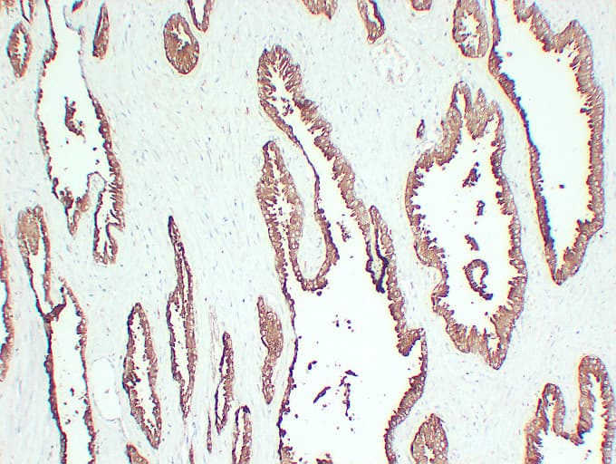 Monoclonal Mouse anti-Human ACPP / PAP Antibody (clone ABT-PSAP, IHC)