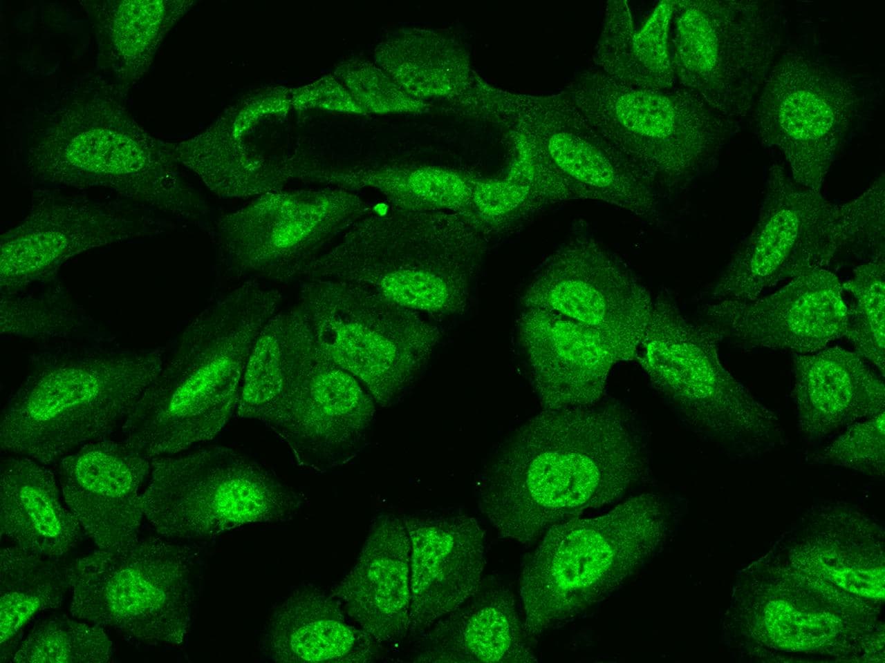 Polyclonal Rabbit anti-Human UBAP2L Antibody (IHC, IF)