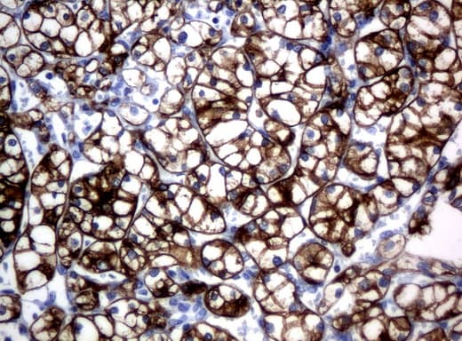 KRT18 / CK18 / Cytokeratin 18 Antibody (aa69-372, clone UMAB50)