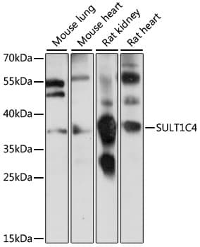 Polyclonal Rabbit anti-Human SULT1C4 / Sulfotransferase 1C4 Antibody (WB)