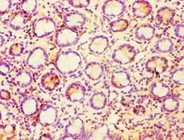 Polyclonal Rabbit anti-Human CASP6 / Caspase 6 Antibody (aa24-293, IHC, WB)