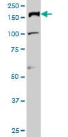 TOP2A / Topoisomerase II Alpha Antibody (clone 1E2)