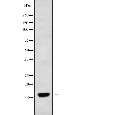 CRCP / CGRP Receptor Component Antibody