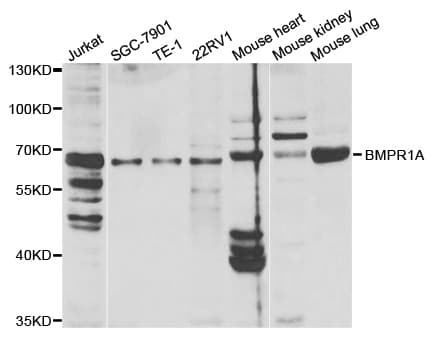 Polyclonal Rabbit anti-Human ALK3 / BMPR1A Antibody (IHC, WB)