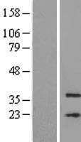 Human MFSD3 Protein (Over-Expression Lysate Myc-DDK (Flag))