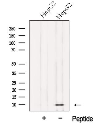 NDUFV3 Antibody