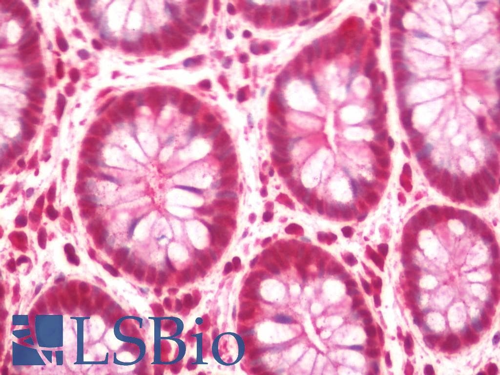 IHC-plus™ C2CD3 Antibody