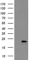 COMMD1 Antibody (clone OTI3B3)