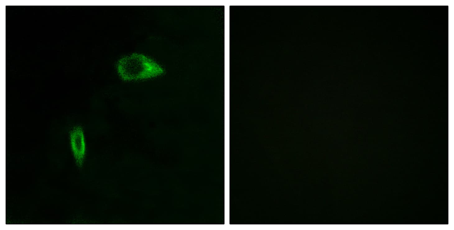 COL14A1 / Collagen XIV Antibody (aa71-120)