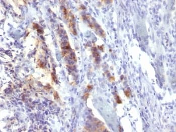 MUC5AC Antibody (clone SPM488)