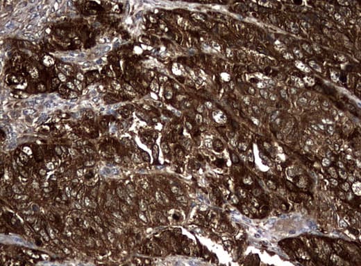 NME1 / NM23 Antibody (clone UMAB91)