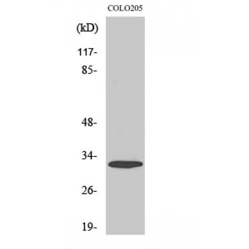 Polyclonal Rabbit anti-Human ACER3 Antibody (140-220 aa, Internal, IHC, IF, WB)