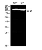 CR2 / CD21 Antibody