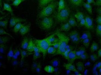 IHC-plus™ FLCN / Folliculin Antibody (N-Terminus)