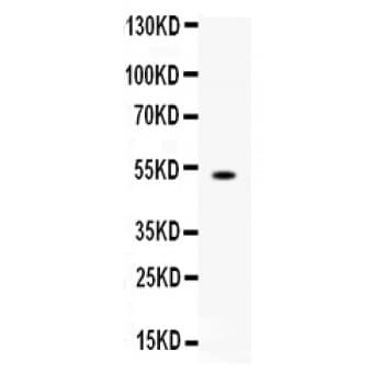 FCGRT / FCRN Antibody (aa54-291)