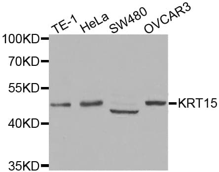 KRT15 / CK15 / Cytokeratin 15 Antibody