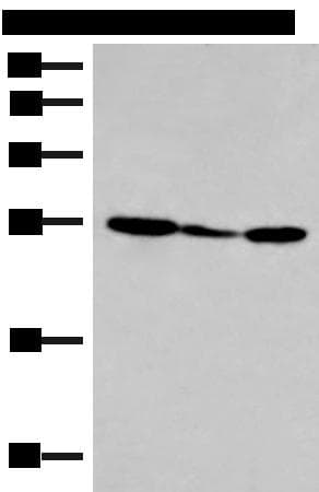 Polyclonal Rabbit anti-Human HLA-DOB Antibody (IHC, WB)