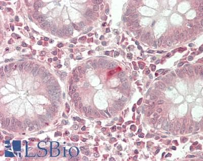 IHC-plus™ PEAK1 / SGK269 Antibody (aa111-160)