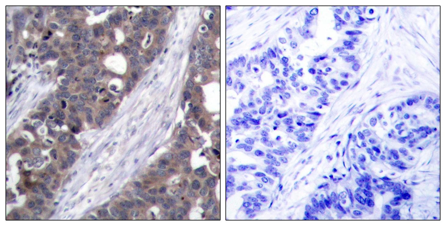 RPS6KB1 / P70S6K / S6K Antibody (p411)