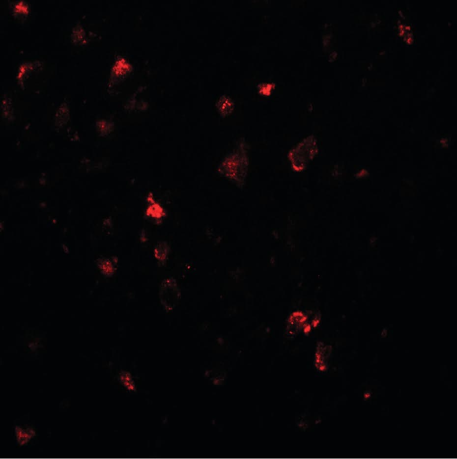 IHC-plus™ LMX1A Antibody