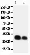 Polyclonal Rabbit anti-Human CRTC1 / MECT1 / TORC1 Antibody (aa506-521, WB)