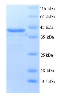 Human HPTPB / PTPRB Protein (Recombinant His)