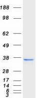 Human NUDT18 Protein (Recombinant Myc-DDK (Flag))