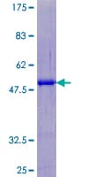 Human SART3 Protein (Recombinant GST)