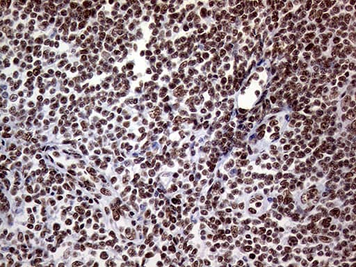 RING1 Antibody (aa88-362, clone OTI3G7)