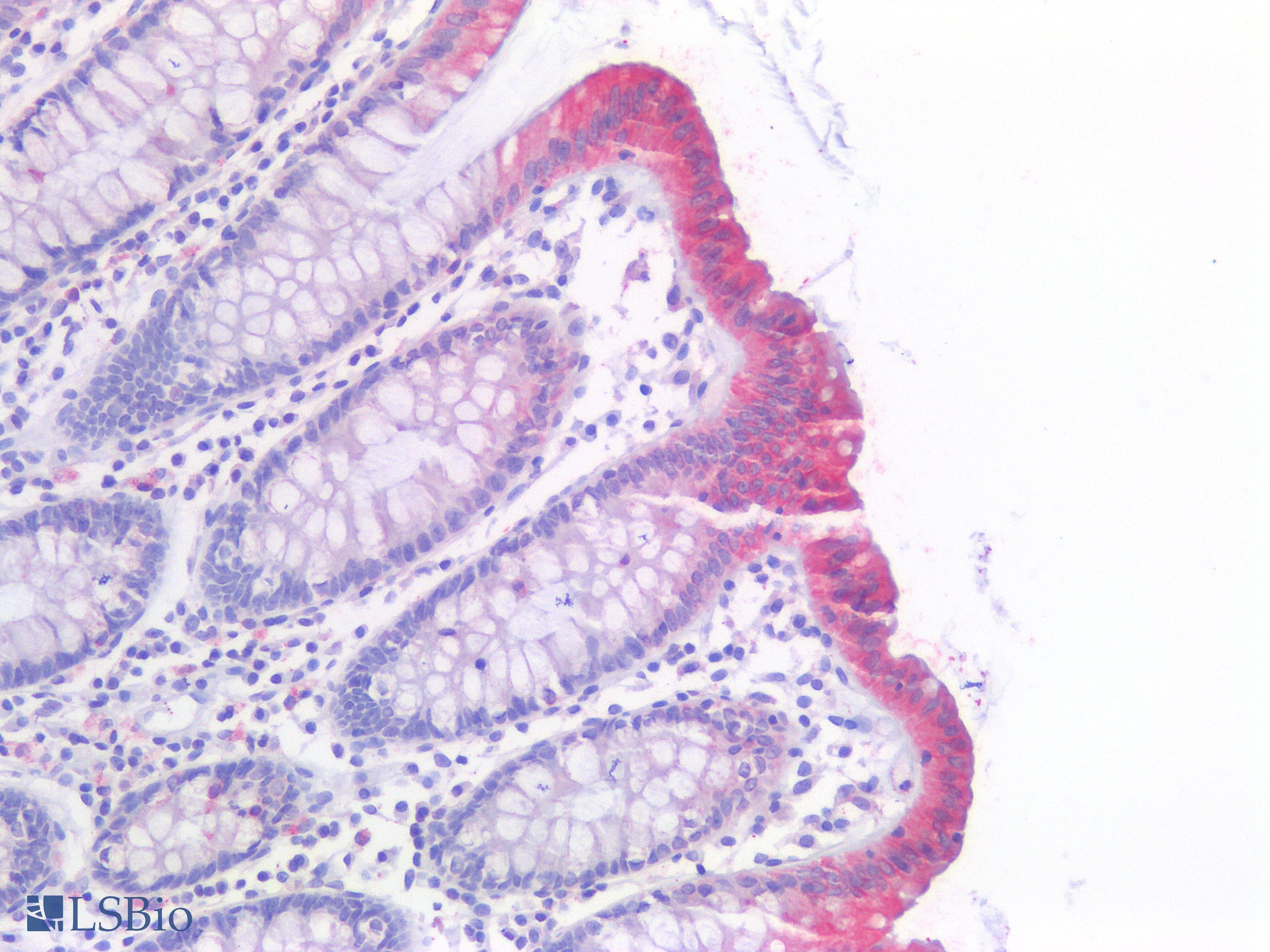 PathPlus™ p16INK4a / CDKN2A Antibody (Concentrated)