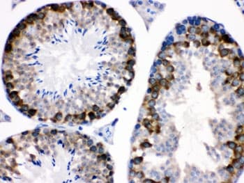 Polyclonal Rabbit anti-Human STMN1 / Stathmin / LAG Antibody (IHC, WB)