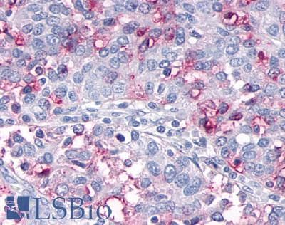 PathPlus™ OR10R2 Antibody (Extracellular Domain)