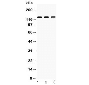 NPHS1 / Nephrin Antibody