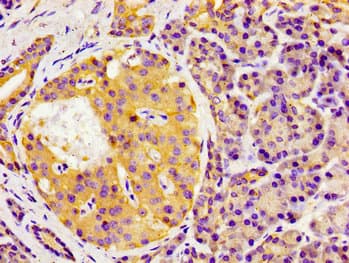 Polyclonal Rabbit anti-Human GAS1 Antibody (IHC, WB)
