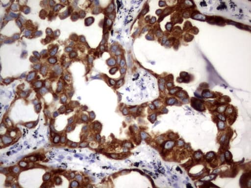 Acidic Cytokeratin Antibody (clone 8F5)