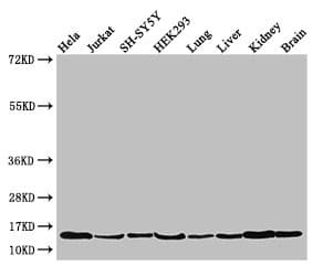 Polyclonal Rabbit anti-Human PAIP2 Antibody