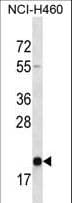 TMED2 Antibody (aa50-79)