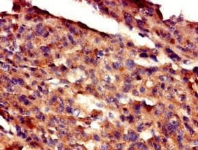 GAS7 Antibody