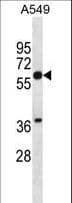 ERG1 / SQLE Antibody (aa68-97)