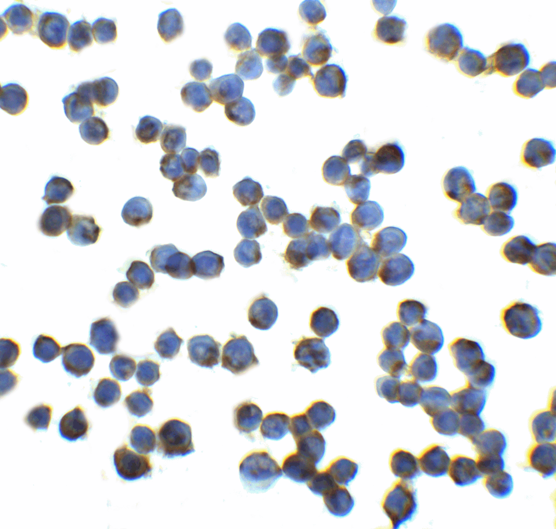 IHC-plus™ Polyclonal Rabbit anti-Human RFX / RFX1 Antibody (IHC, IF, WB)